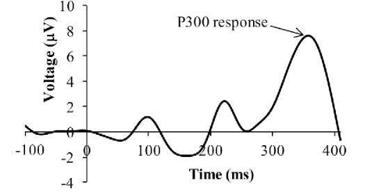 通过脑机接口实现医疗突破：马斯克宣布2025年Neuralink的植入计划_马斯克脑植入芯片_大脑植入设备